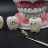 Трещина в эмали зуба