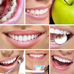 Как отбелить зубы дома?