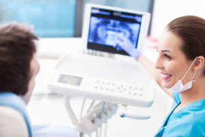 Как выбрать имплантат зуба