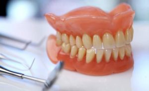 Съемный зубной протез на верхнюю челюсть