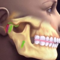 Болит сустав в челюсти